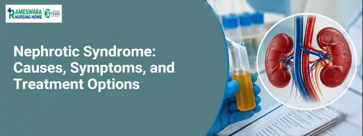 Nephrotic Syndrome