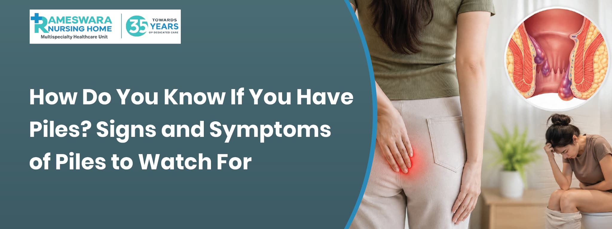 How Do You Know If You Have Piles? Signs and Symptoms 